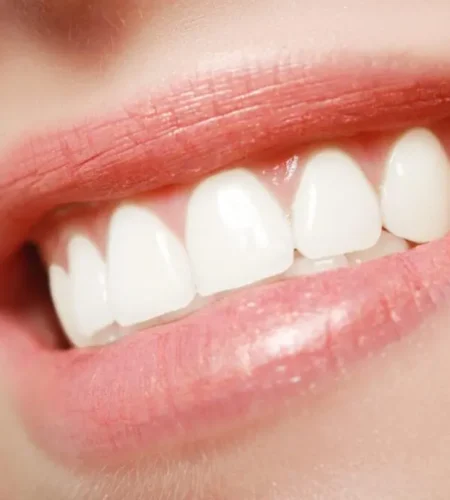 5 Signs You Might Be a Good Candidate for Clear Aligners in Richmond