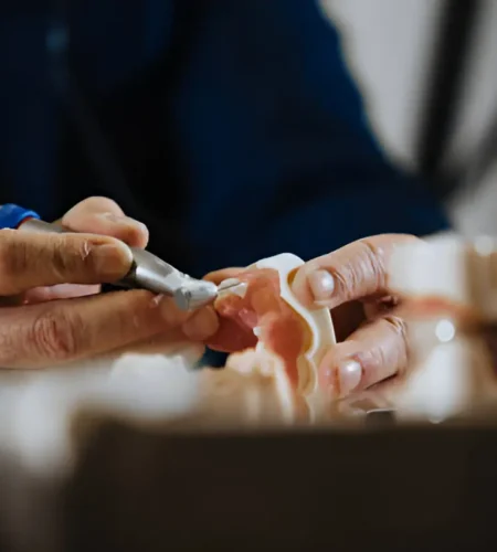 How Modern Dentures Are Custom-Made Just for You A Step-by-Step Guide