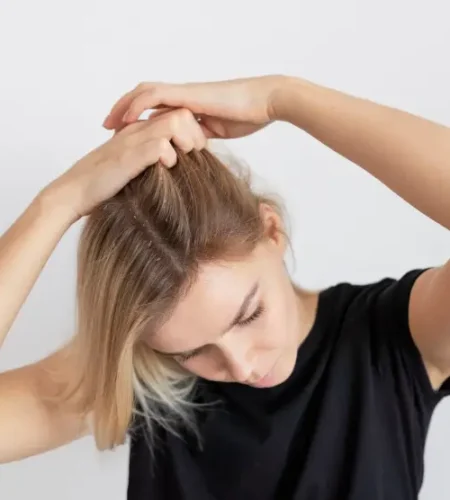 What Causes Itchy Scalp and How to Treat It